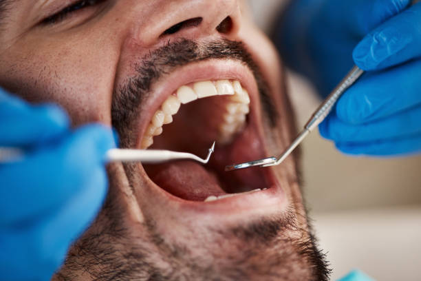 Best Emergency Tooth Extraction in Marmora, NJ